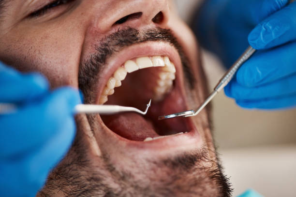 Best Emergency Wisdom Teeth Removal in Daniels, WV